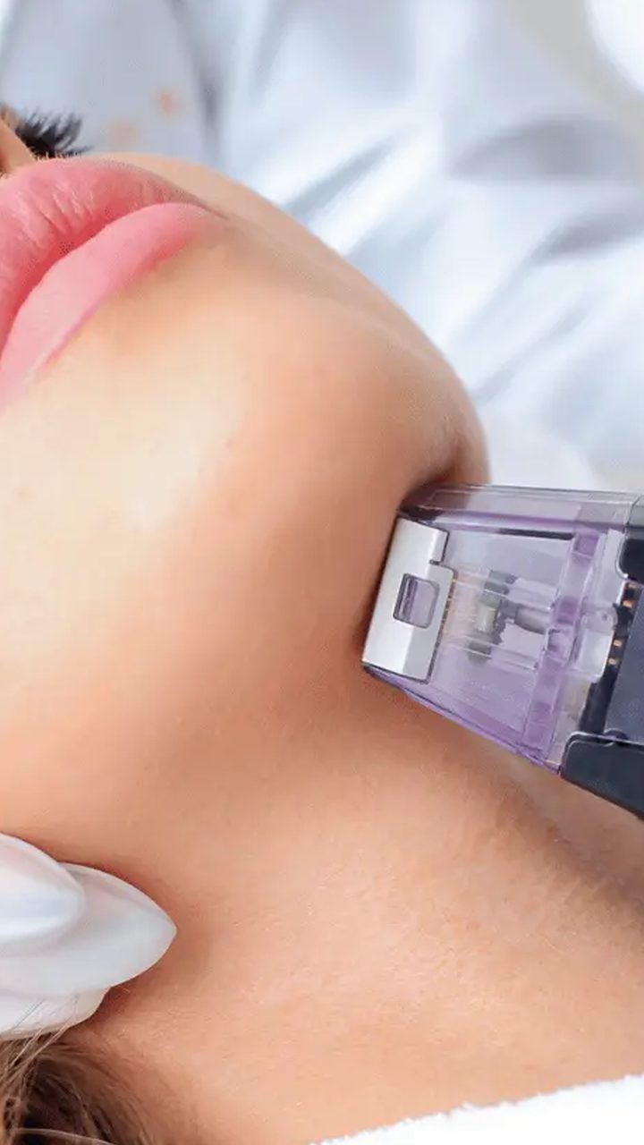 Radiofrequency
