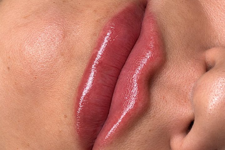 Lip filler