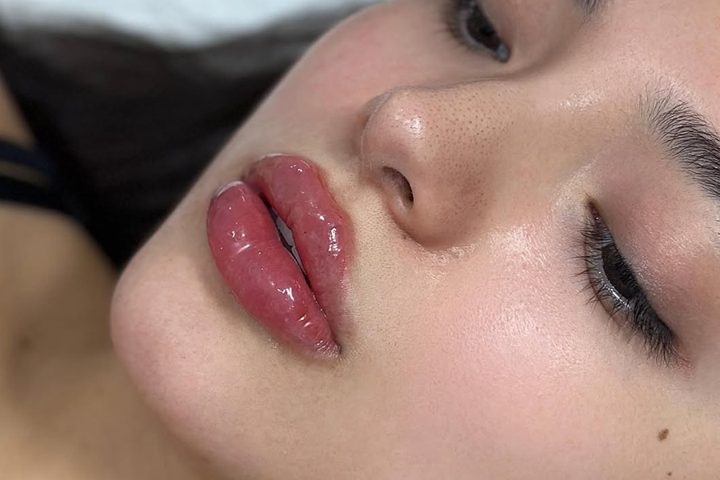 Natural lips